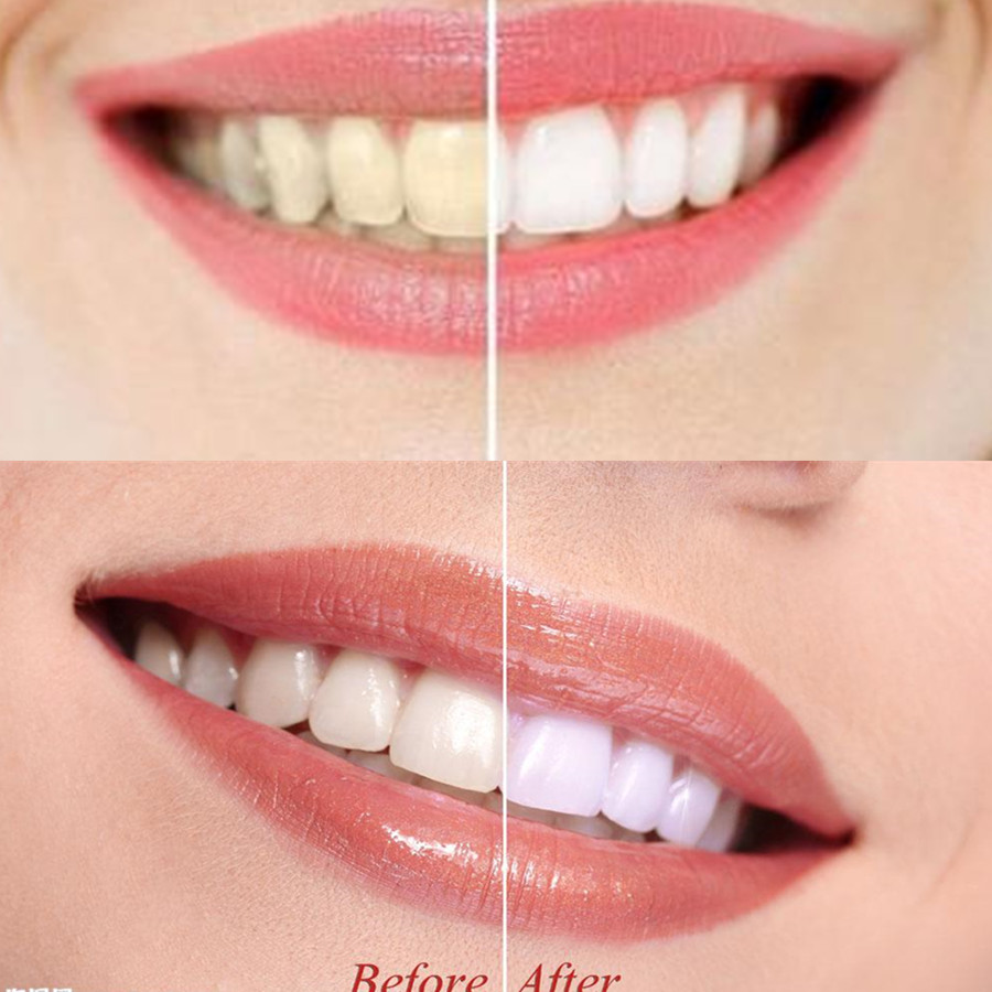 Бамбуковый уголь для зубов, ст – обзор и цена Teeth Whitening Ingredients