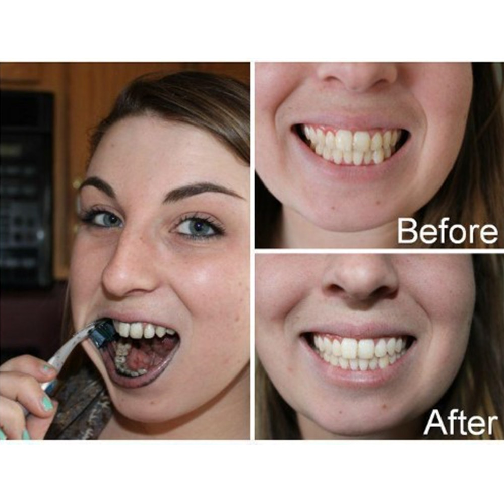Бамбуковый уголь для зубов, ст – обзор и цена Teeth Whitening Ingredients