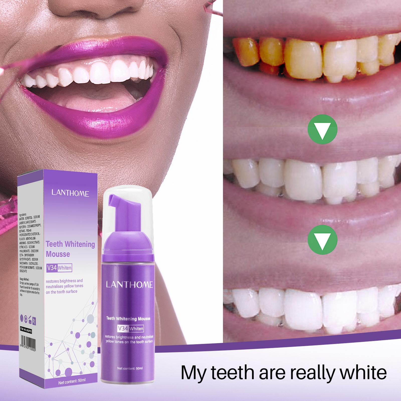 50 мл мусс для отбеливания зуб – обзор и цена Teeth Whitening Foam Toothpaste