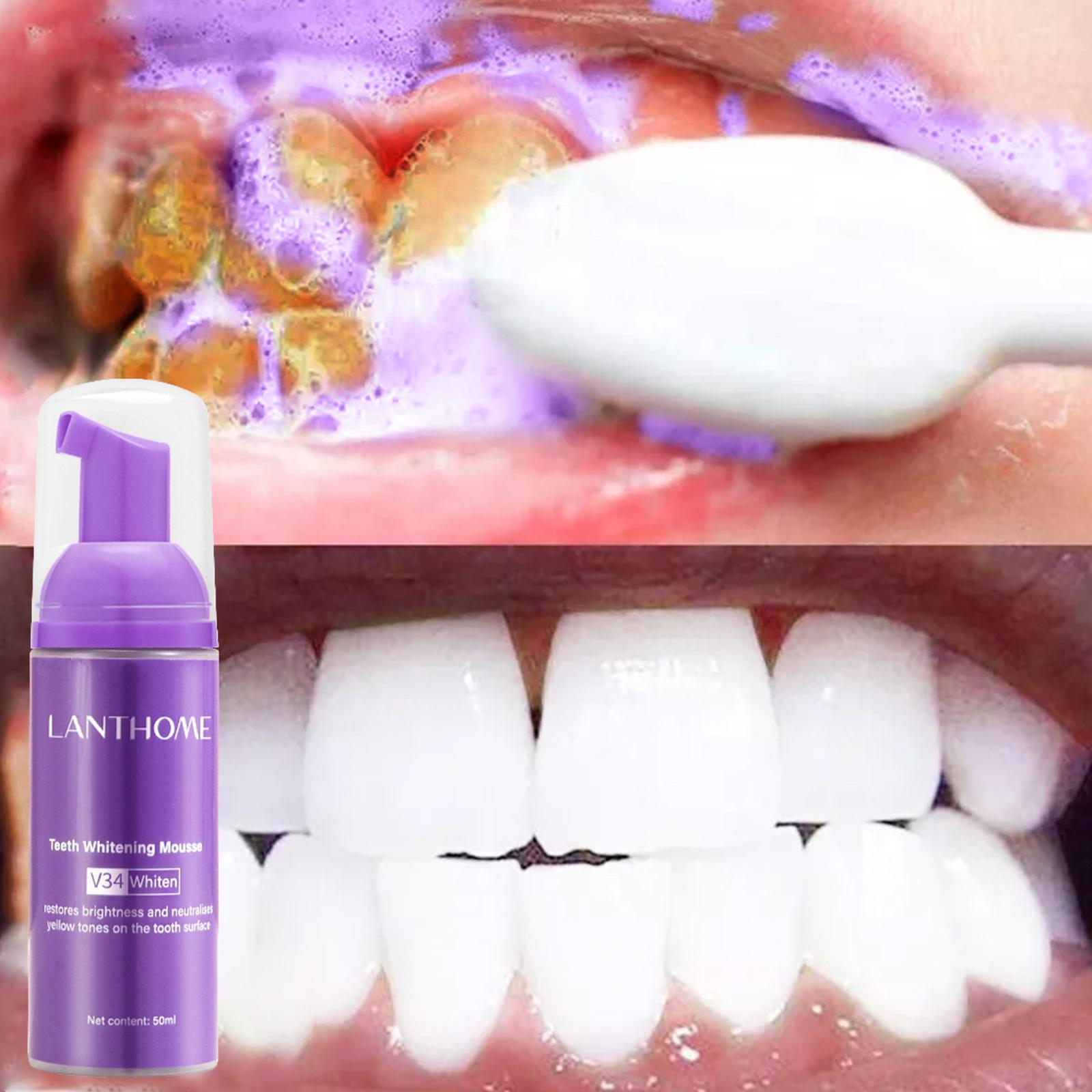50 мл мусс для отбеливания зуб – обзор и цена Teeth Whitening Foam Toothpaste