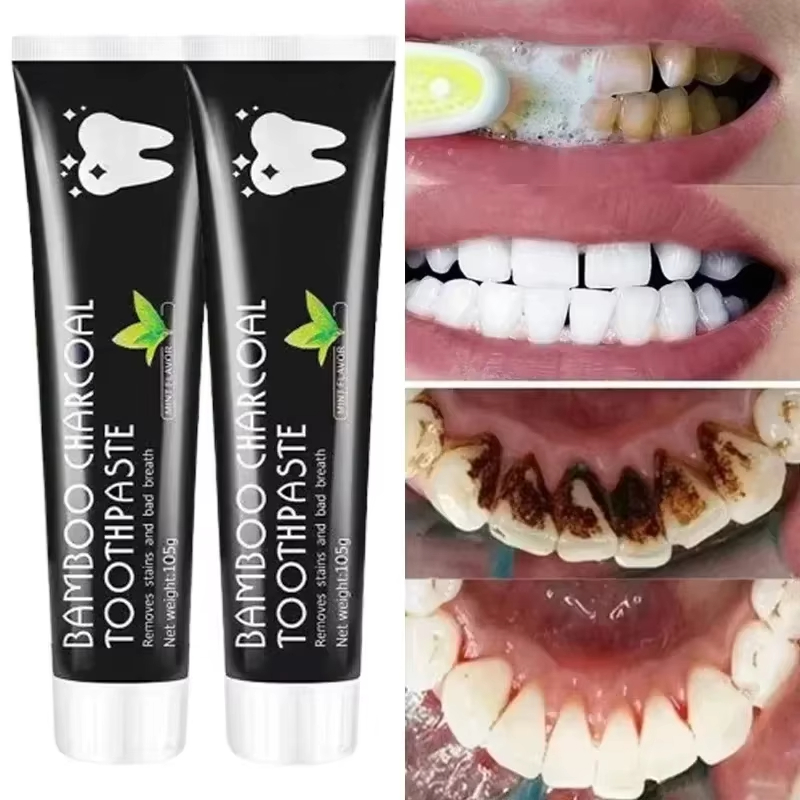 Отбеливающая зубная паста Зубн – обзор и цена Teeth Whitening Yellow Teeth