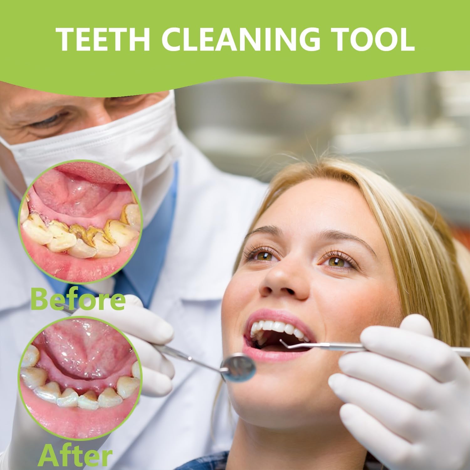 Профессиональный набор для чис – обзор и цена Teeth Whitening Machine Professional