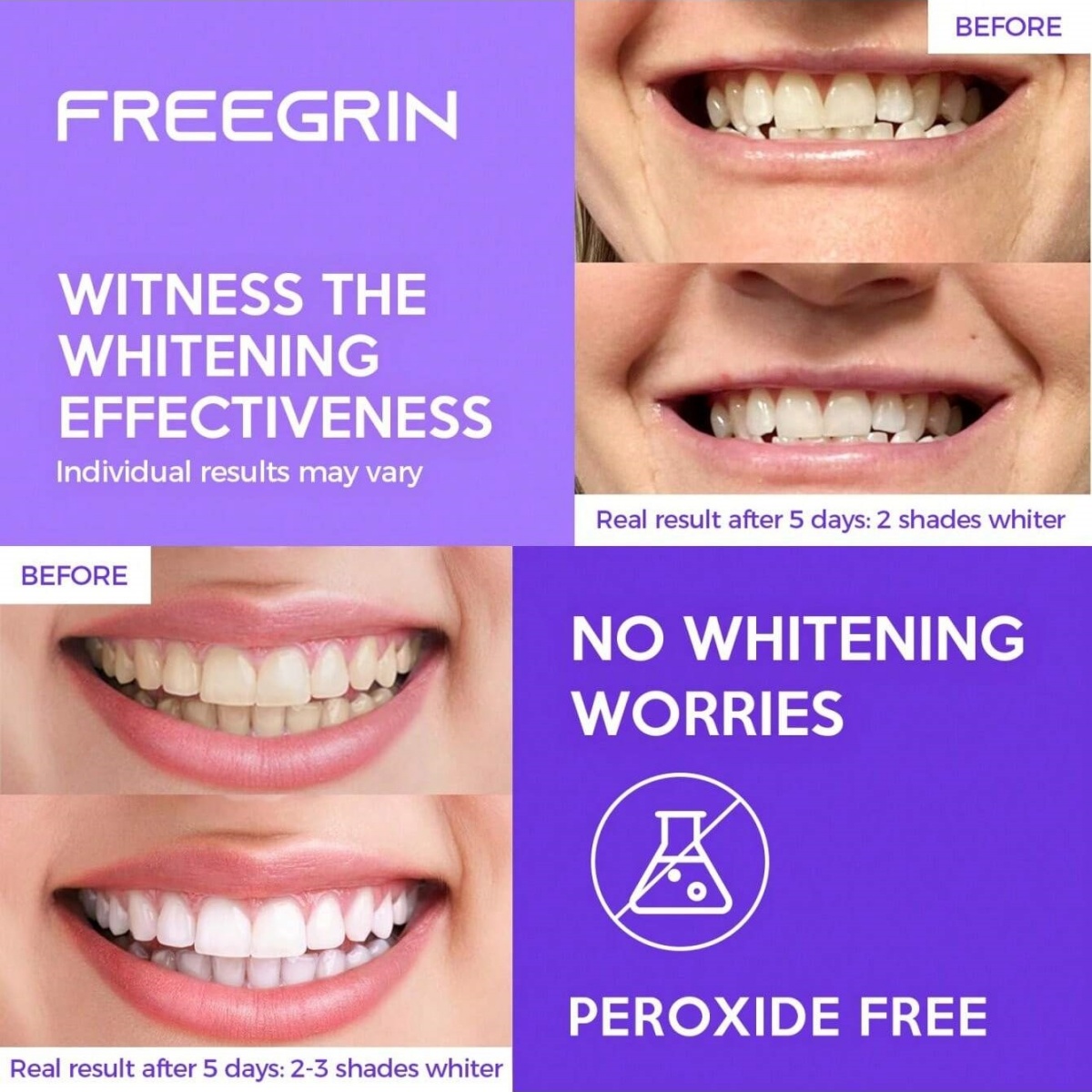 Роскошные отбеливающие наклейк – обзор и цена Teeth Whitening Gel Peroxide