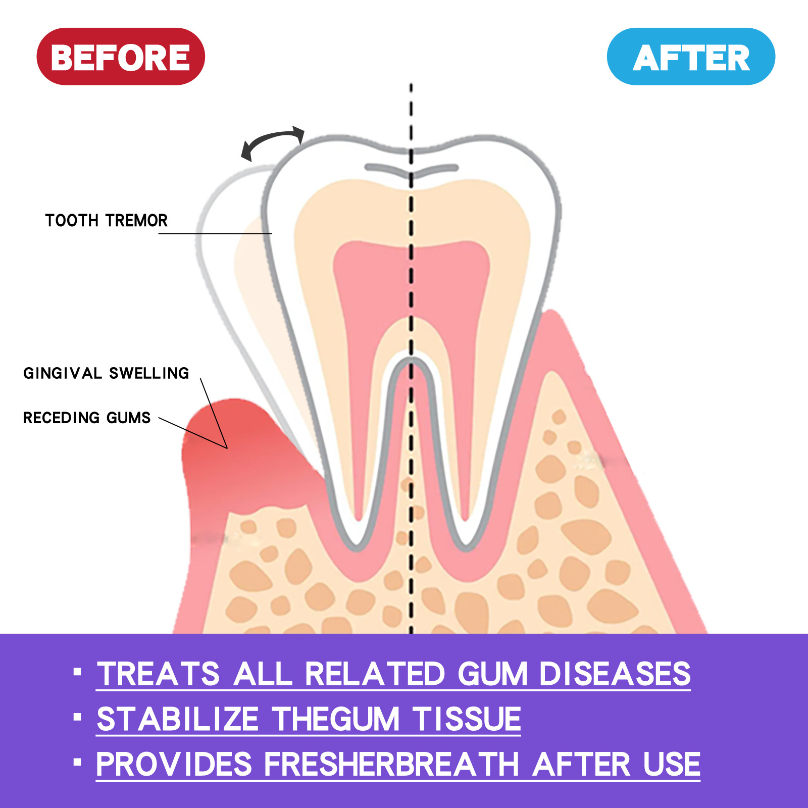 60 мл мусс для отбеливания зуб – обзор и цена Teeth Whitening Yellow Teeth